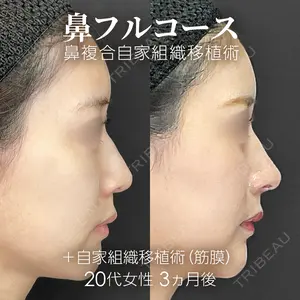 ジョウクリニック 銀座院 重本　譲医師の症例