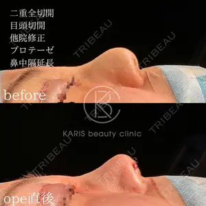 KARIS beauty clinic 滝内 ヒロフミ医師の症例