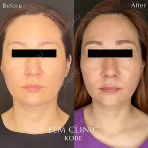 美容皮膚科エルムクリニック 京都院の症例