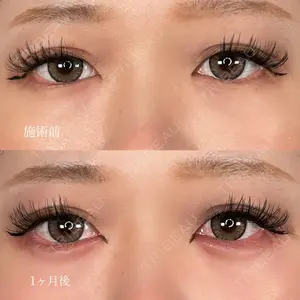 ASTRA BEAUTY CLINIC 塩満 惠子医師の症例