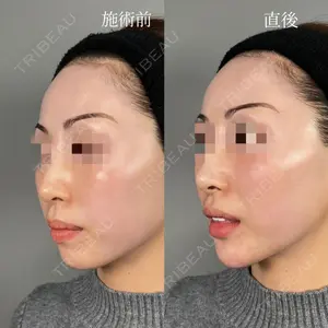 ASTRA BEAUTY CLINIC 塩満 惠子医師の症例