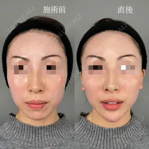 ASTRA BEAUTY CLINIC 塩満 惠子医師の症例