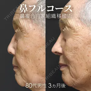 ジョウクリニック 銀座院 重本　譲医師の症例