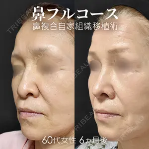 ジョウクリニック 銀座院 重本　譲医師の症例