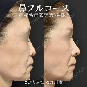 ジョウクリニック 銀座院 重本　譲医師の症例
