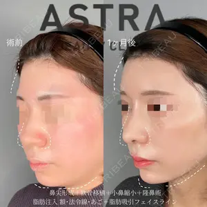 ASTRA BEAUTY CLINIC 塩満 惠子医師の症例