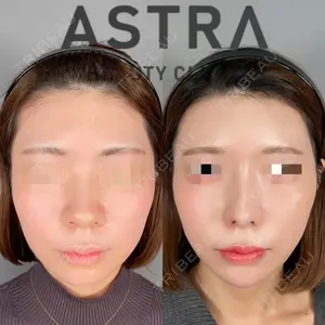 ASTRA BEAUTY CLINIC 塩満 惠子医師の症例