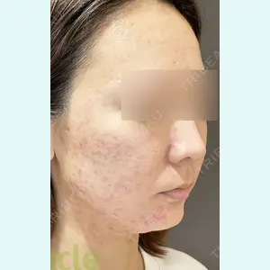 オラクル美容皮膚科 名古屋院の症例