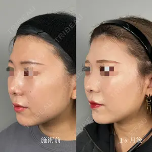 ASTRA BEAUTY CLINIC 塩満 惠子医師の症例