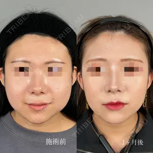 ASTRA BEAUTY CLINIC 塩満 惠子医師の症例