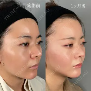 ASTRA BEAUTY CLINIC 塩満 惠子医師の症例