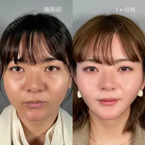 ASTRA BEAUTY CLINIC 塩満 惠子医師の症例