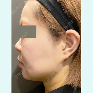 Wi Clinic（ウィ クリニック） 吉祥寺院の症例