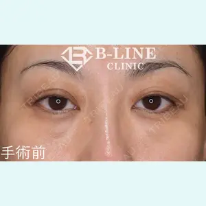 B-LINE CLINIC 池袋院 小池 康弘医師の症例