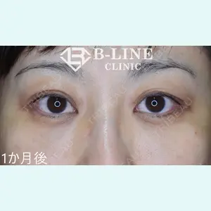 B-LINE CLINIC 池袋院 小池 康弘医師の症例