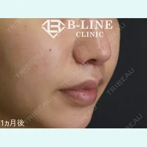 B-LINE CLINIC 池袋院 小池 康弘医師の症例