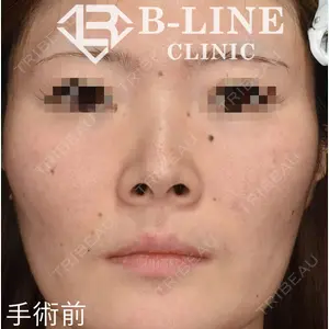 B-LINE CLINIC 池袋院 小池 康弘医師の症例