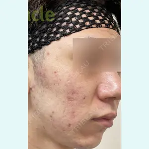 オラクル美容皮膚科 名古屋院の症例