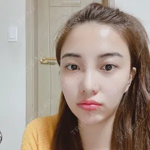 DI（ディアイ）整形外科 チョン・ヨンイク (JUN GYUN IK M.D)院長医師の症例