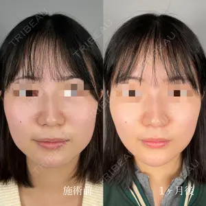 ASTRA BEAUTY CLINIC 塩満 惠子医師の症例