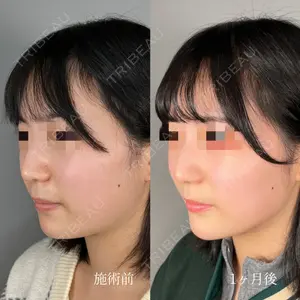 ASTRA BEAUTY CLINIC 塩満 惠子医師の症例