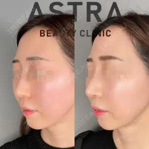 ASTRA BEAUTY CLINIC 塩満 惠子医師の症例