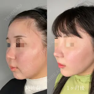 ASTRA BEAUTY CLINIC 塩満 惠子医師の症例