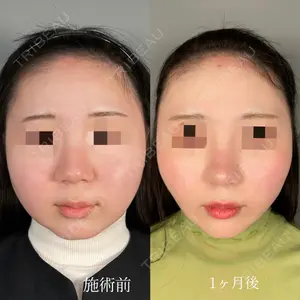 ASTRA BEAUTY CLINIC 塩満 惠子医師の症例