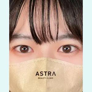 ASTRA BEAUTY CLINIC 塩満 惠子医師の症例