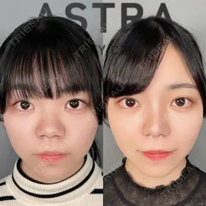 ASTRA BEAUTY CLINIC 塩満 惠子医師の症例