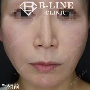 B-LINE CLINIC 池袋院 小池 康弘医師の症例