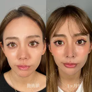 ASTRA BEAUTY CLINIC 塩満 惠子医師の症例