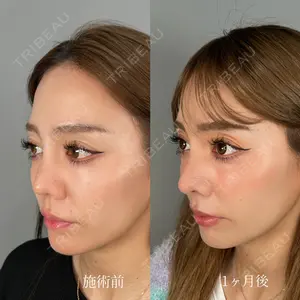 ASTRA BEAUTY CLINIC 塩満 惠子医師の症例