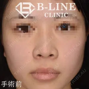 B-LINE CLINIC 池袋院 小池 康弘医師の症例