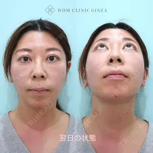 WOM CLINIC GINZA （ワム クリニック ギンザ） 深堀 純也医師の症例