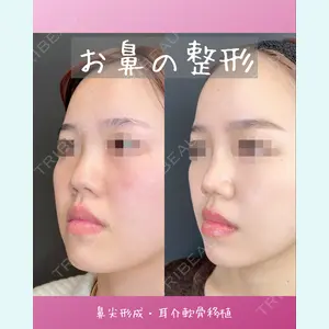 ルラ美容クリニック 渋谷本院 中村 桜子医師の症例