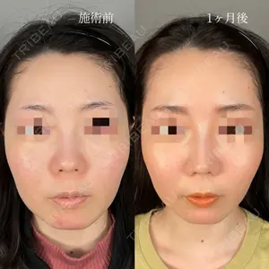 ASTRA BEAUTY CLINIC 塩満 惠子医師の症例