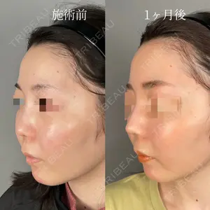 ASTRA BEAUTY CLINIC 塩満 惠子医師の症例