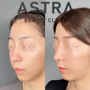 ASTRA BEAUTY CLINIC 塩満 惠子医師の症例