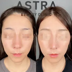 ASTRA BEAUTY CLINIC 塩満 惠子医師の症例