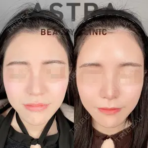 ASTRA BEAUTY CLINIC 塩満 惠子医師の症例