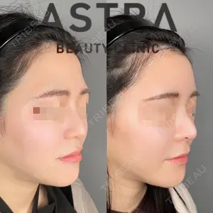 ASTRA BEAUTY CLINIC 塩満 惠子医師の症例