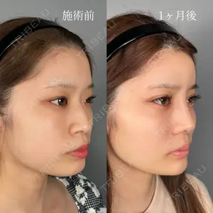 ASTRA BEAUTY CLINIC 塩満 惠子医師の症例