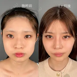 ASTRA BEAUTY CLINIC 塩満 惠子医師の症例