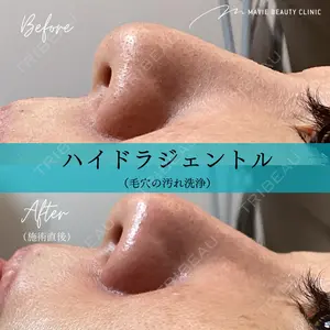 Mavie Beauty Clinic （マヴィービューティークリニック）の症例