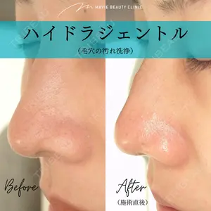 Mavie Beauty Clinic （マヴィービューティークリニック）の症例