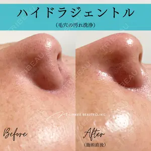 Mavie Beauty Clinic （マヴィービューティークリニック）の症例