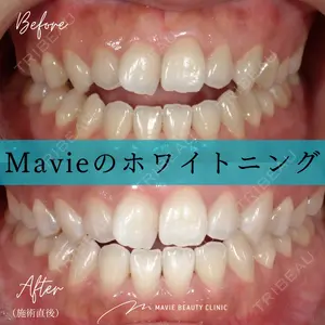 Mavie Beauty Clinic （マヴィービューティークリニック） 渡邉 憲一郎医師の症例