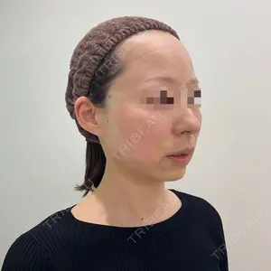ユウコ形成外科クリニック 植田　有子医師の症例
