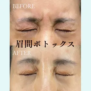 HAAB×DREAM BEAUTY CLINIC 東京本院 佐野 圭医師の症例